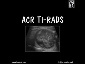 ACR TI-RADS