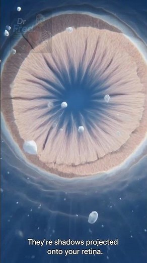 what causes eye floaters? the science behind those mysterious moving spots