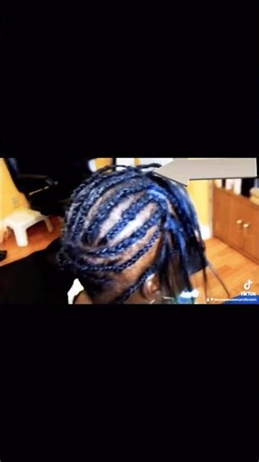 I Finally Found A Safe Braid Pattern For HairLoss & Thin Edges