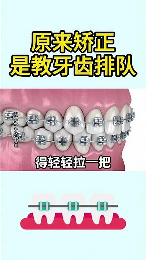 It turns out that orthodontics is about teaching teeth to line up!