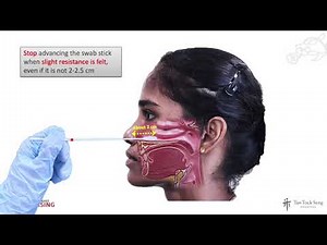 Collection of Oropharyngeal (OP), Nasal Mid-Turbinate (NMT), or Nasopharyngeal (NP) swab