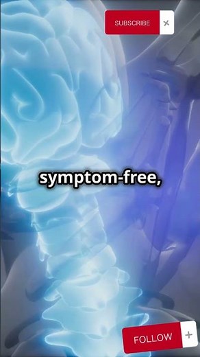 What is Arachnoid cyst??🔥🔥🔥#arachnoid #cystic