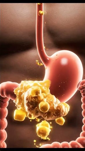 Croissant Digestion 🥐 | How Your Body Breaks Down Pastries