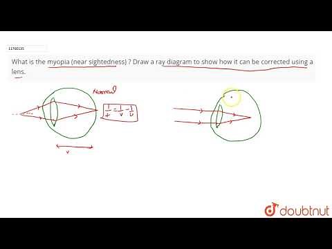 What is the myopia (near sightedness) ? Draw a ray diagram to show how it can be
