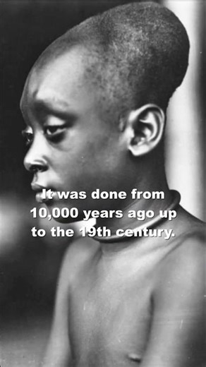 Why were ancient skulls elongated?!