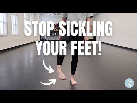 How to Fix a Sickled Foot