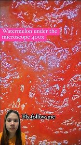 618K views · 1.9K reactions | Watermelon under the microscope #credittotherightfulownerofthisvideo #howtotrainyourdragon #SpaceX #HappyMensDay #groceryshopping #backbritishfarming #watermelon #watermelonlover #melonmicroscope #microscope #microscopeview | Stephany Marie | Facebook