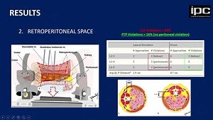 Study of Major Vessels Positions in Lateral and Prone Decubitus
