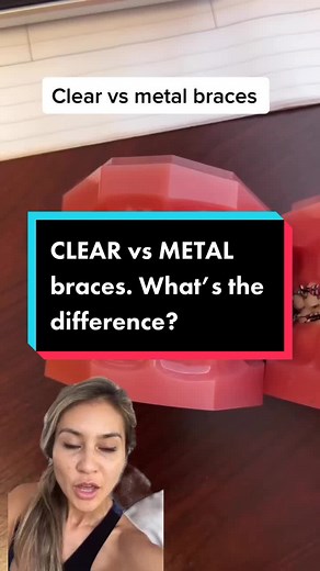 Clear vs Metal Braces: Understanding the Difference
