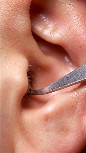 ASMR Ear Pick Cleaning Loop | Satisfying Macro Close-up