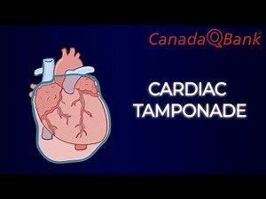 Cardiac Tamponade Explained | Beck’s Triad, Diagnosis & Emergency Treatment | CanadaQBank