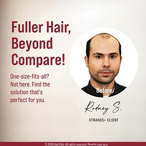 2.9K views | When it comes to hair restoration, one solution doesn’t...