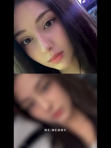 Reberry Clinic Gangnam: Premier Skin Care in Seoul