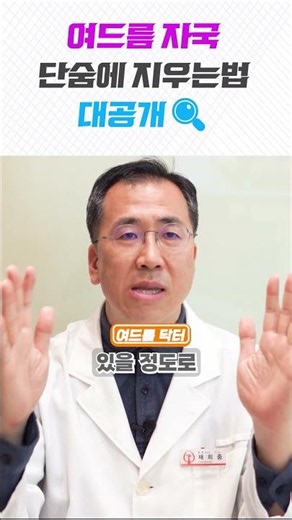 여드름 자국✨단숨에 지우는법❗️대공개 #여드름흉터 #여드름자국 #여드름흉터없애는방법 #여드름흉터없애는법 #여드름자국없애는법#shorts