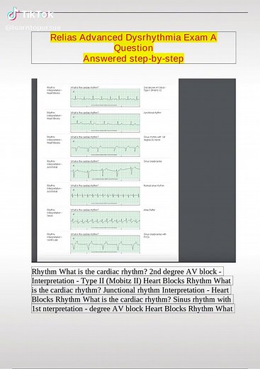 Relias Advanced Dysrhythmia Exam: 100% Correct Answers
