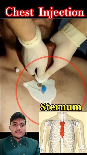 Emergency Injection ❤️ #cardiacarrest #shock #emergency #injection