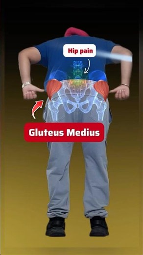Hip pain ✅ | #physiowaladoctor #backpain #backpainrelief #backache #hippain #hippainexercises