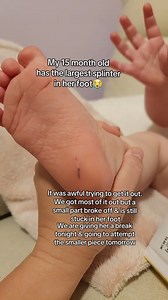 3.1M views · 7.1K reactions | My poor girl got the largest splinter...