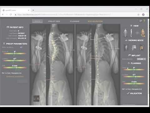 Low-dose 3D X-ray imaging