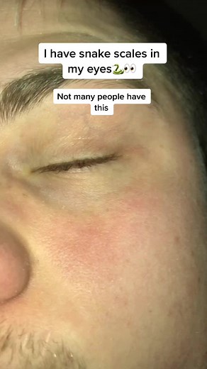 Human Snake Eyes: The Enigmatic Gaze Revealed