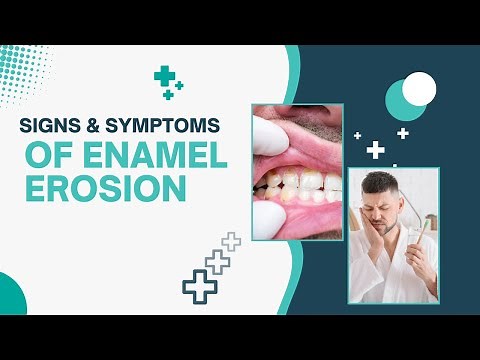 Signs and Symptoms of Enamel Erosion: 3 Effective Treatments