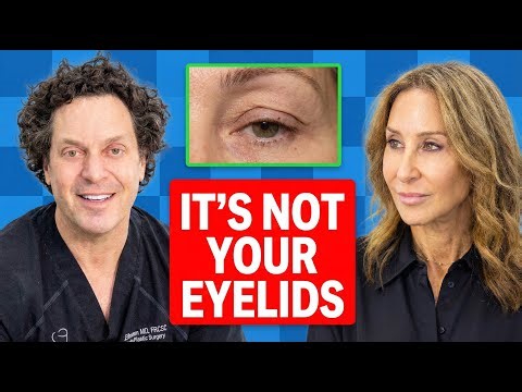 Brow Lift vs Upper Blepharoplasty: Which One Do You Actually Need? | The UnPhiltered Podcast