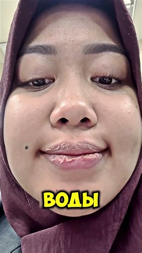 What to do if your lips are chapped in winter ❄️💄