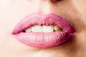 Bouche sèche : causes, que faire ?