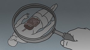 How Neuromodulators Can Treat Functional GI Disorders