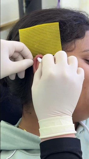 This Piercing Changed Everything 🔥 Vertical Helix Reveal #vertical #helixpiercing #daithpiercing
