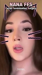 A Key Surgery for Transgender Women #FFS 🌈#mtf