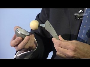 Hüftgelenk | Hüftgelenksarthrose / Coxarthrose