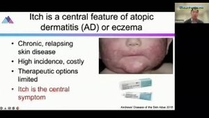 How Do We Sense the World Around Us? Why Do We Itch and How Can We Treat Chronic Itch?