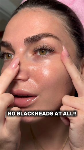 B E A T R I X 🧿 on Instagram: "My 5-month check-in with FULLY Clay Mask Cleanser 💚 @caagency #PoreMask #MaskCleanser #skincareroutine #skincaretips #glassskin"