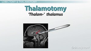 Terminology for Procedures Related to the Brain and Nerves