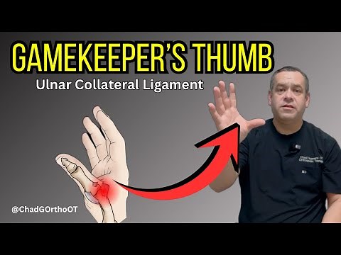 Gamekeeper’s Thumb Injury (UCL Tear) | What It Is & How to Rehab It