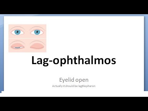Ophthalmology 387 a LagOphthalmos Eyelid open eye Causes Treatment Sleeping with Eye open