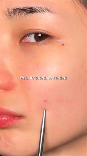 Angry, red skin to calm & balanced ✨Using @NURICLEUSA @NURICLEME to reset my barrier