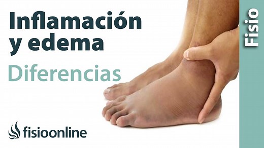¿Qué diferencia existe entre un edema y una inflamación?