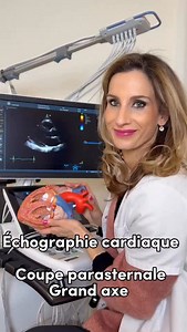 L’échographie cardiaque est un examen indolore et sans rayons X qui permet de visualiser le cœur en temps réel. Une sonde placée sur la poitrine émet des ultrasons. Ces ondes sonores rebondissent sur les structures du cœur. L’appareil analyse le signal réfléchi et le transforme en images dynamiques visibles sur un écran. Cet examen permet d’évaluer : • La taille des cavités cardiaques • La contraction du muscle cardiaque • Le fonctionnement des valves • La circulation du sang grâce au Doppler Il