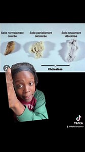 10K reactions · 1K shares | La couleur de ca..ca de ton enfant révèle...