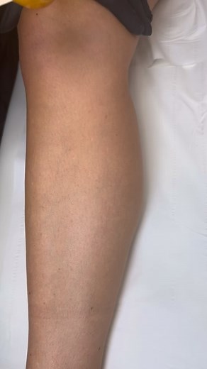 8.1K views · 141 reactions | Elixir hot wax lower leg #waxxinn #smoothskin #painlesswaxing #hardwax #hotwax #foryou #holidays #luxurywaxing #f #waxing #gold#waxingspecialist #asmr | Waxx Inn London | Facebook