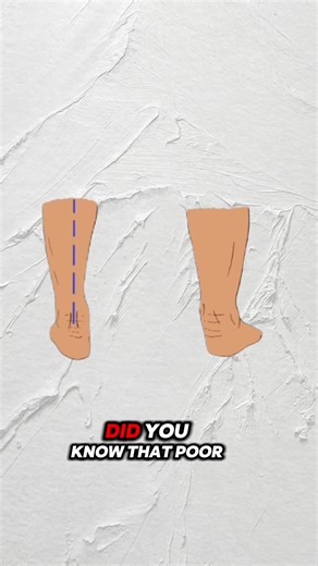 Supination Stealing Your Performance? ⚡ Arch Insoles = Better Stability