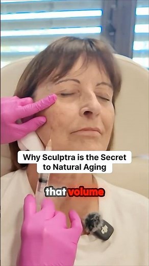 Why Sculptra is the real secret to aging gracefully.