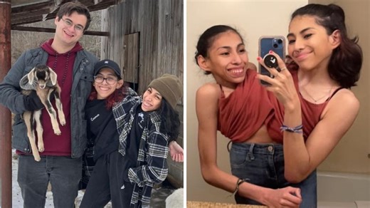 Conjoined twin influencer reveals marriage