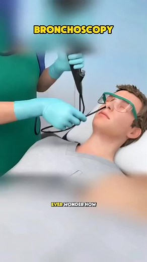 How Bronchoscopy is Performed: 3D Medical Animation