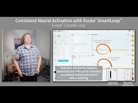 Consistent Neural Activation with Evoke® SmartLoop™ Technology