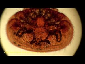 Varroa destructor: Dangerous Parasite of Honeybees Under Microscope X400