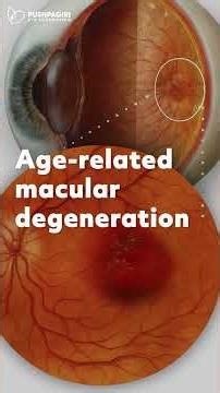 Effects of Alcohol on Vision