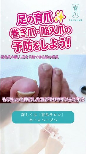 This article introduces foot care methods that can prevent ingrown toenails and other nail problems.